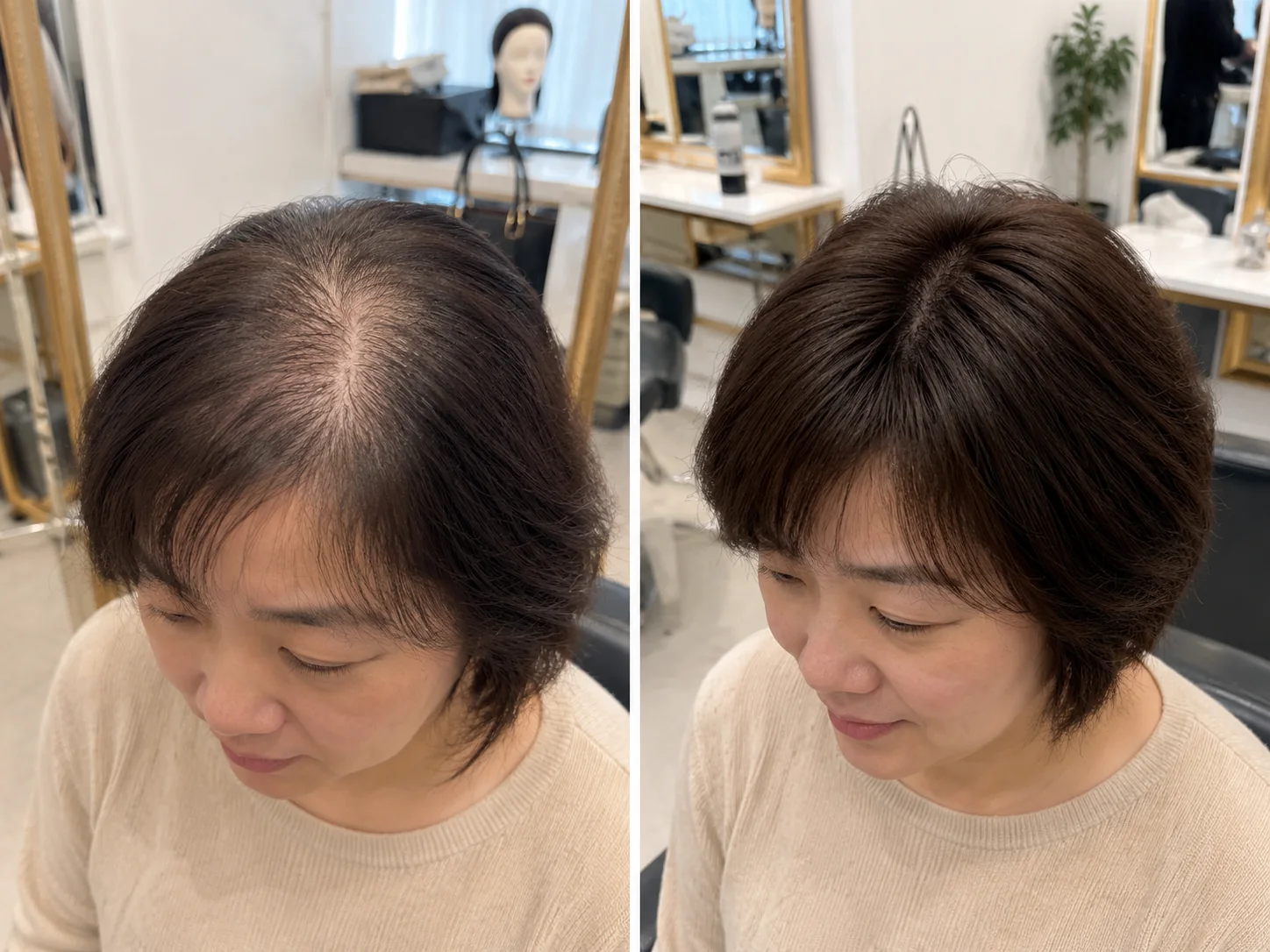 M&MY thinning crown solution before and after comparison showing improved top coverage
